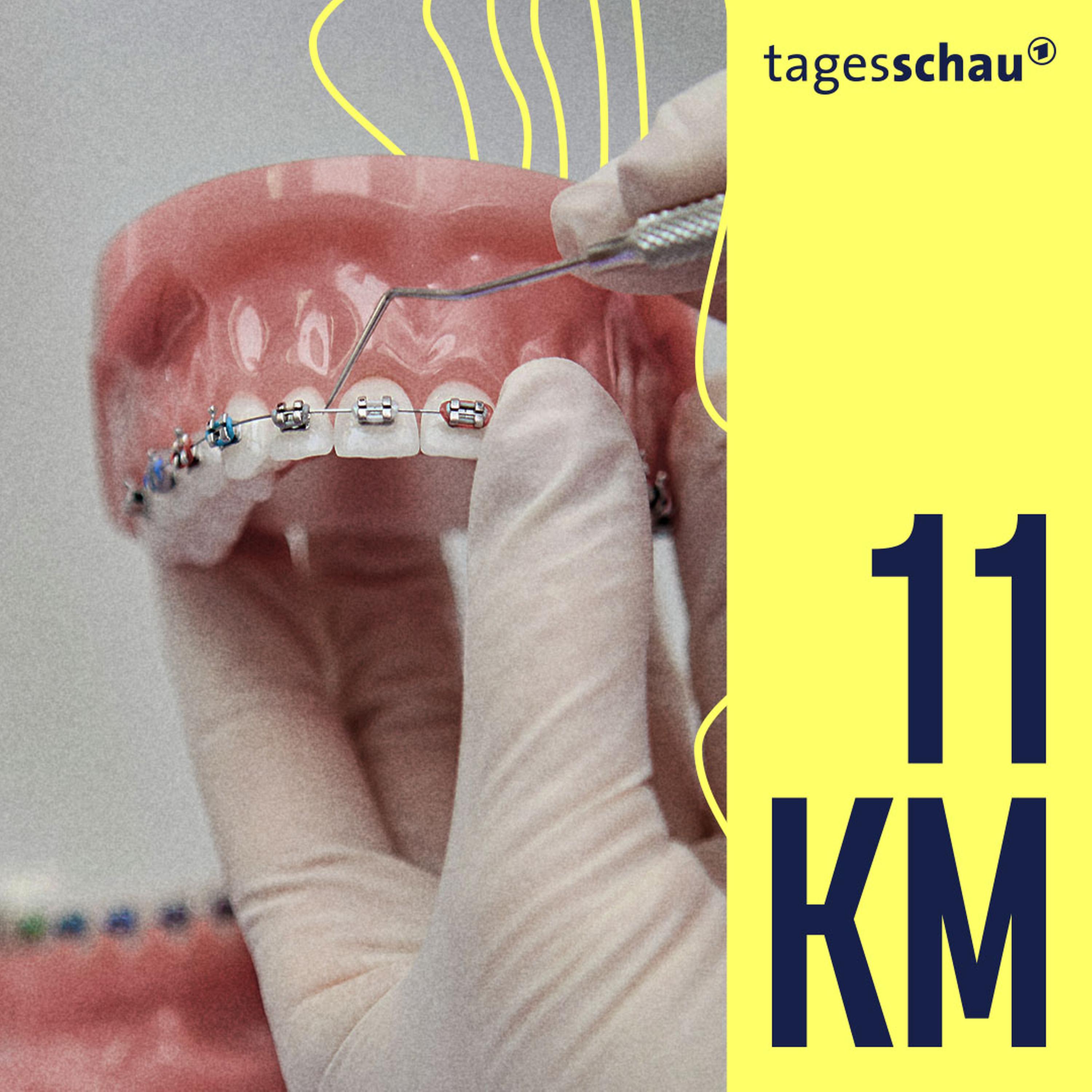 11KM: der tagesschau-Podcast