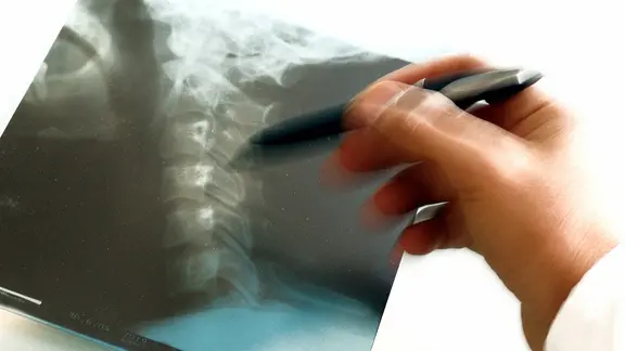 Ein Arzt zeigt mit einem Stift auf das Röntgenbild einer Halswirbelsäule.