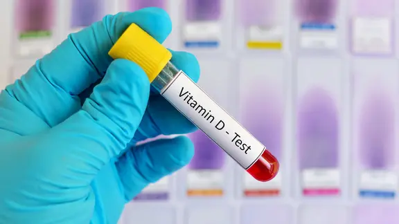 Ampulle mit Blutprobe für Vitamin-D-Test