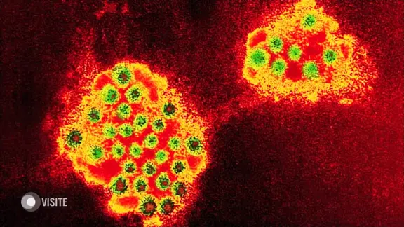 Visualisierung des Norovirus.
