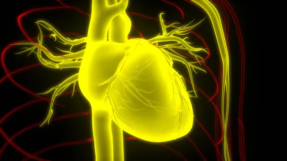 Grafische Darstellung einer Angina Pectoris