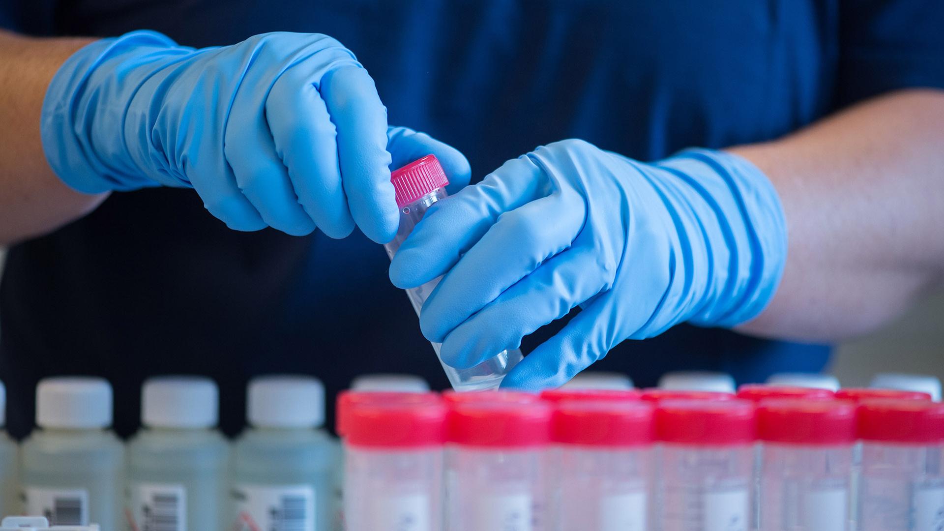 Eine Labormitarbeiterin hält einen Probenbehälter mit behandschuhten Händen.  | picture alliance, dpa Themendienst, Klaus-Dietmar Gabbert