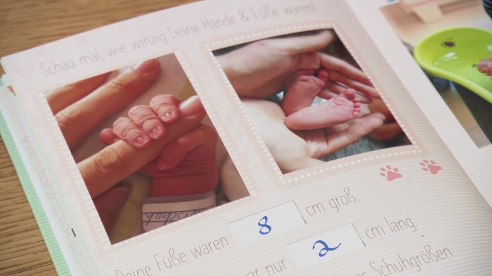Die Geburt des eigenen Kindes ist nicht für alle Eltern eine schöne Erinnerung. | NDR, NDR Ein Babyfotoalbum in dem Bilder von Händen und Füßen zu sehen sind.
