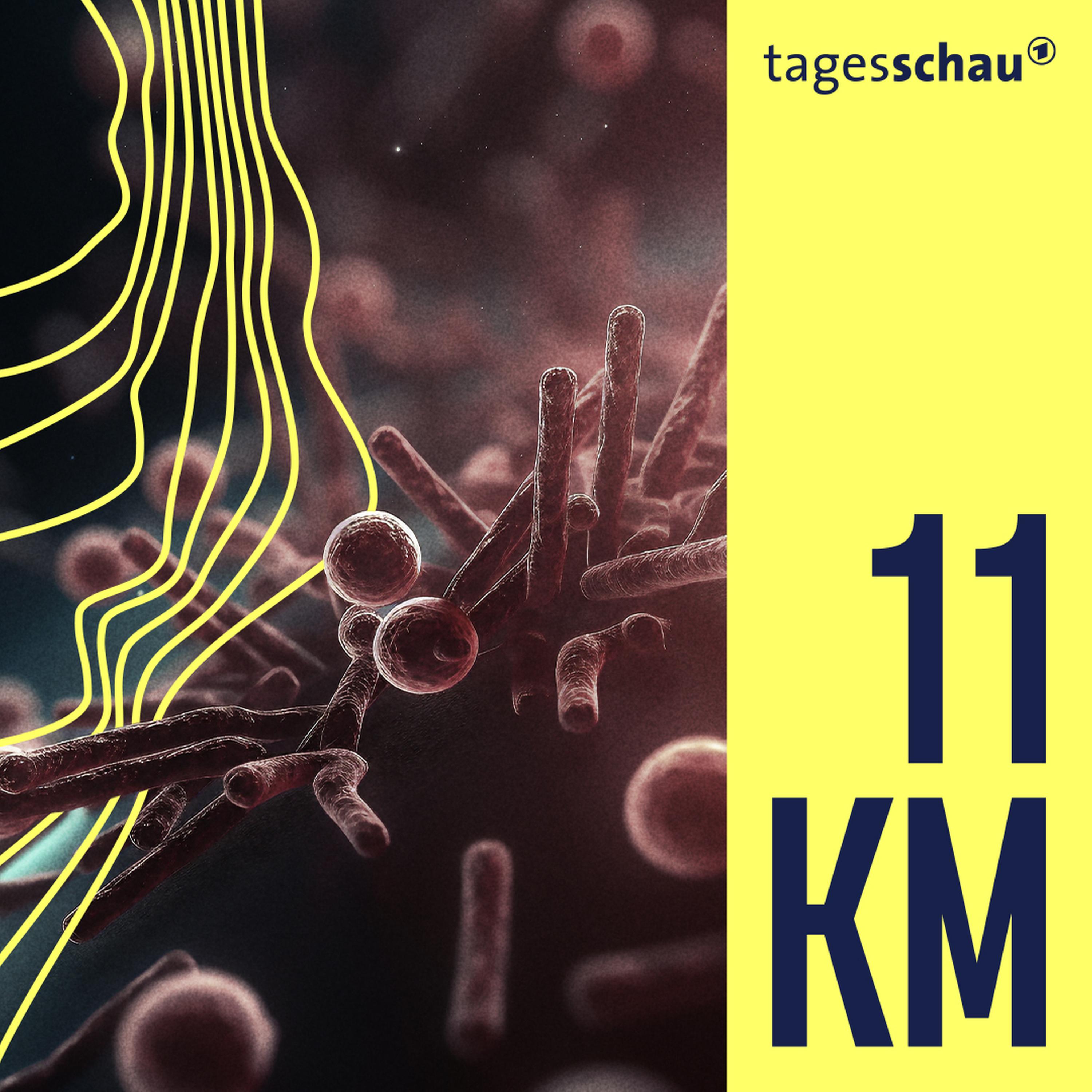 11KM: der tagesschau-Podcast