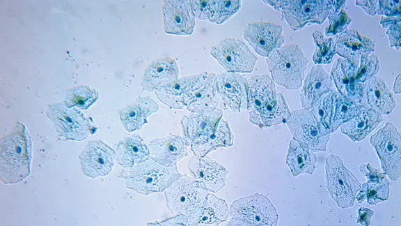 Mikroskopische Aufnahme von Epithelzellen der Mundschleimhaut gefärbt mit Methylenblau. | picture-alliance / dpa / Klett GmbH | Aribert Jung Epithelzellen der Mundschleimhaut
