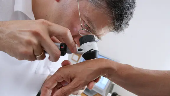 Dermatologe untersucht mit einer Lupe die Haut eines Patienten.