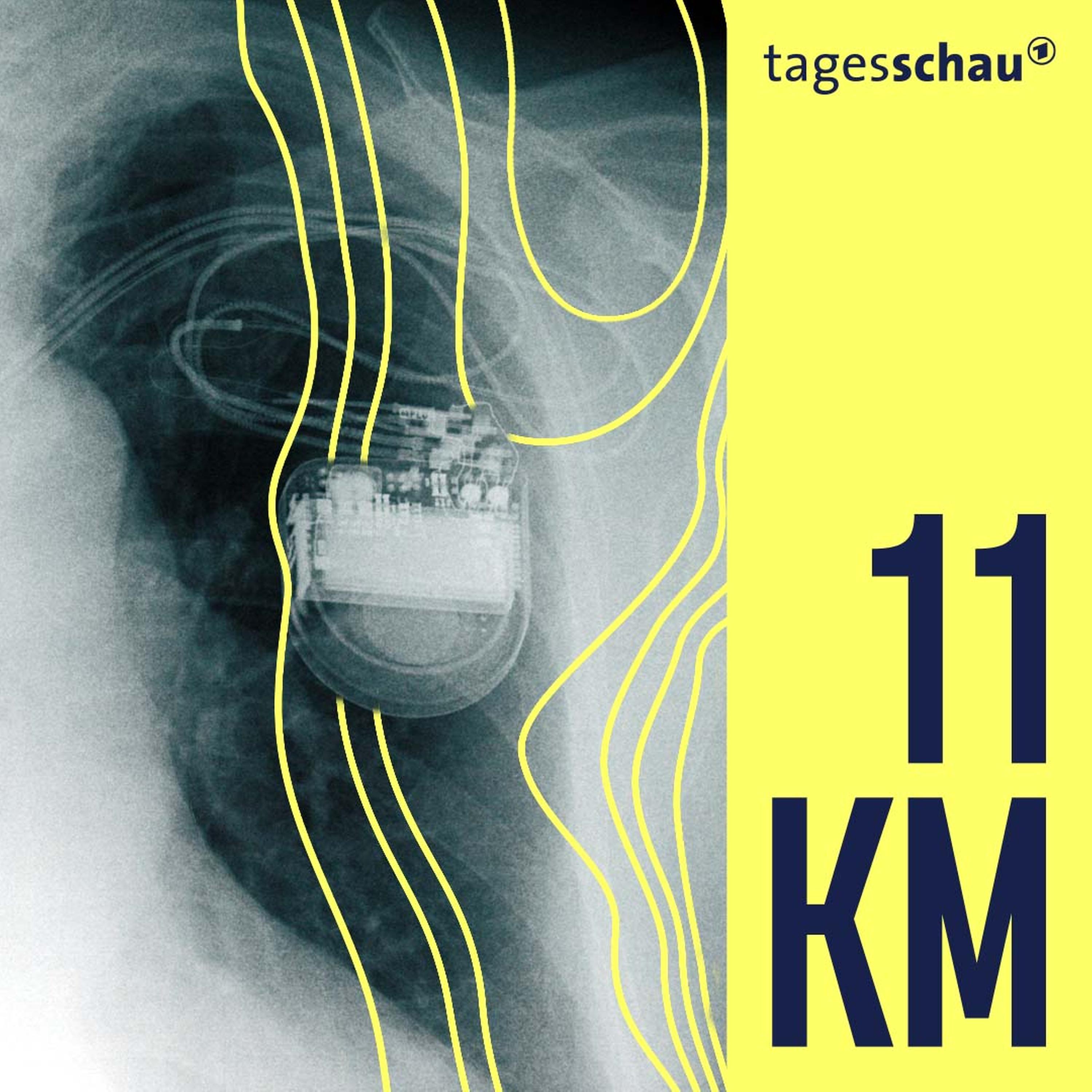 11KM: der tagesschau-Podcast