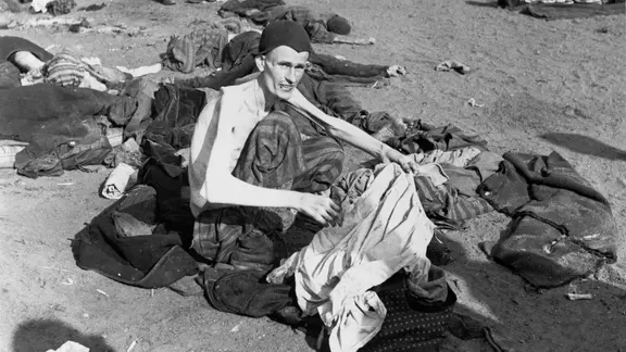 Überlebender des KZ Bergen-Belsen nach der Befreiung des Lagers am 15. April 1945.