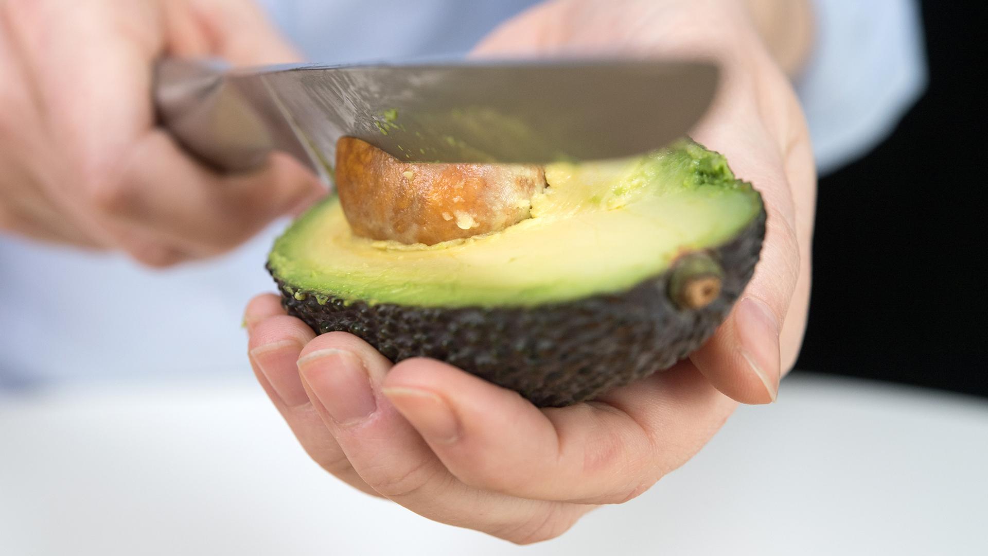 „Avocado-Hand“: Zahl von Schnittverletzungen steigt laut UKSH an