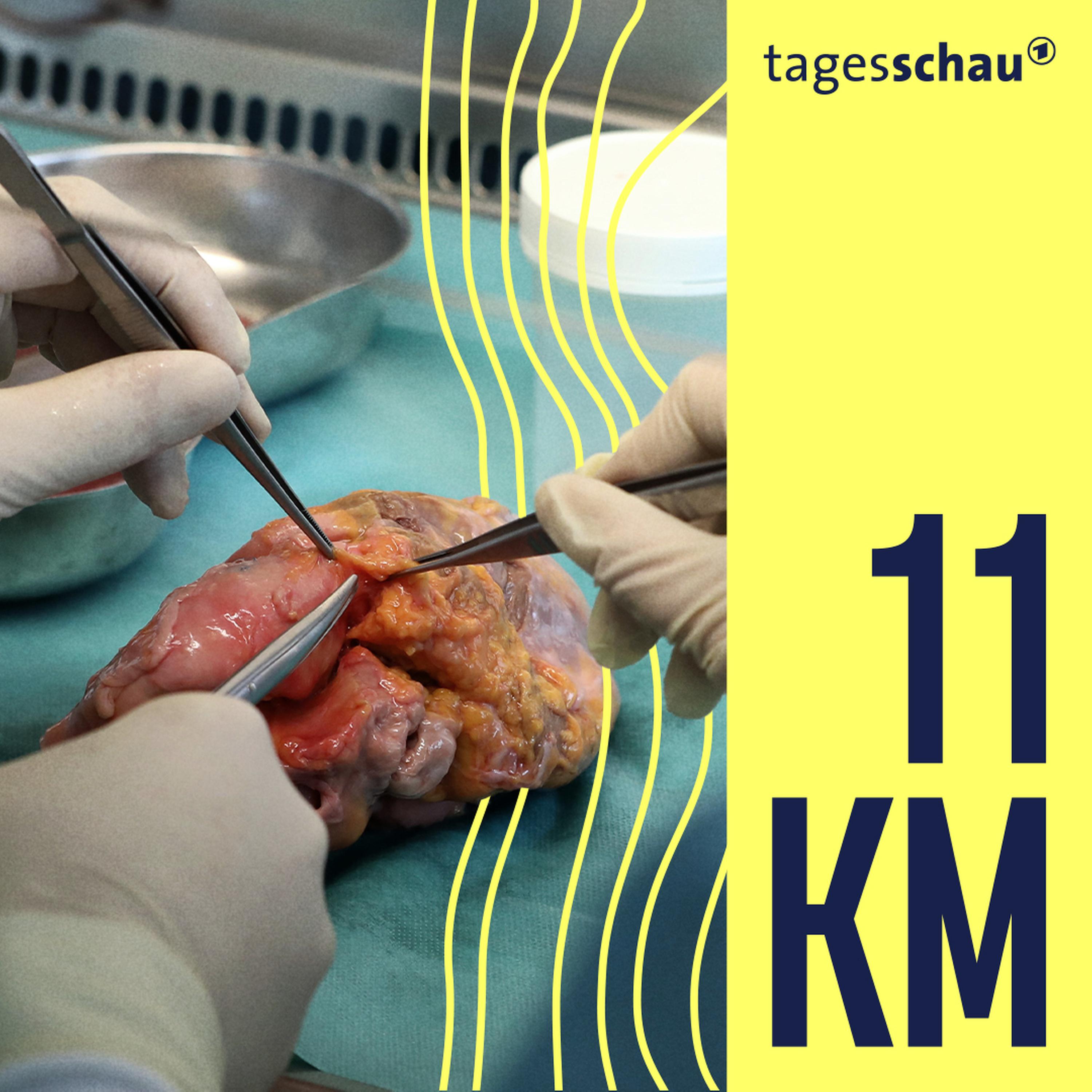 11KM: der tagesschau-Podcast