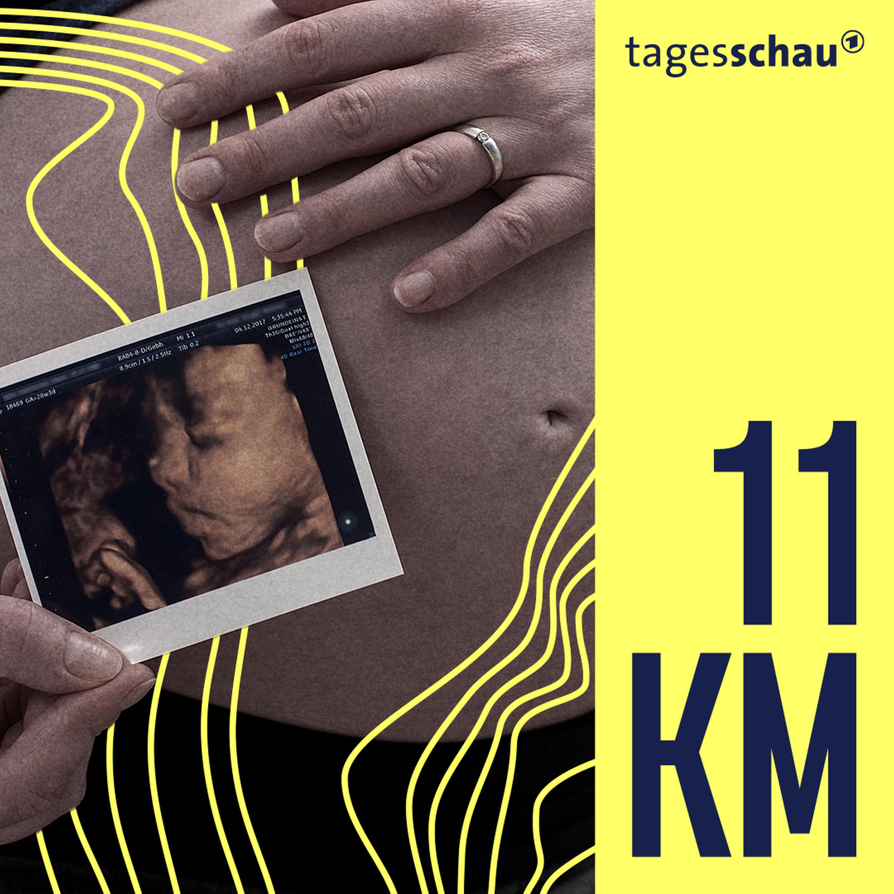 11KM: der tagesschau-Podcast