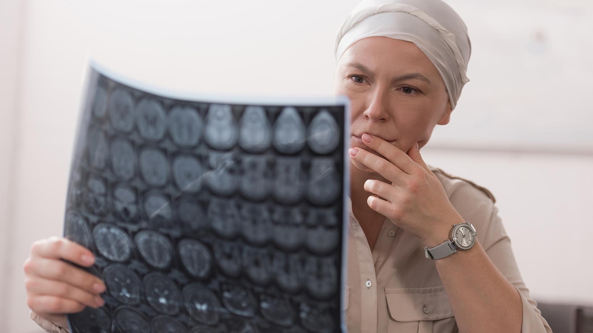 Weltkrebstag: Mehr Krebskranke in Schleswig-Holstein erwartet