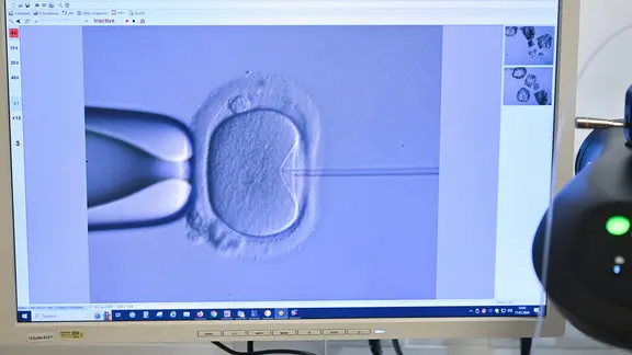 Knstliche Befruchtung: Untersttzung beim Kinderwunsch | ndr.de