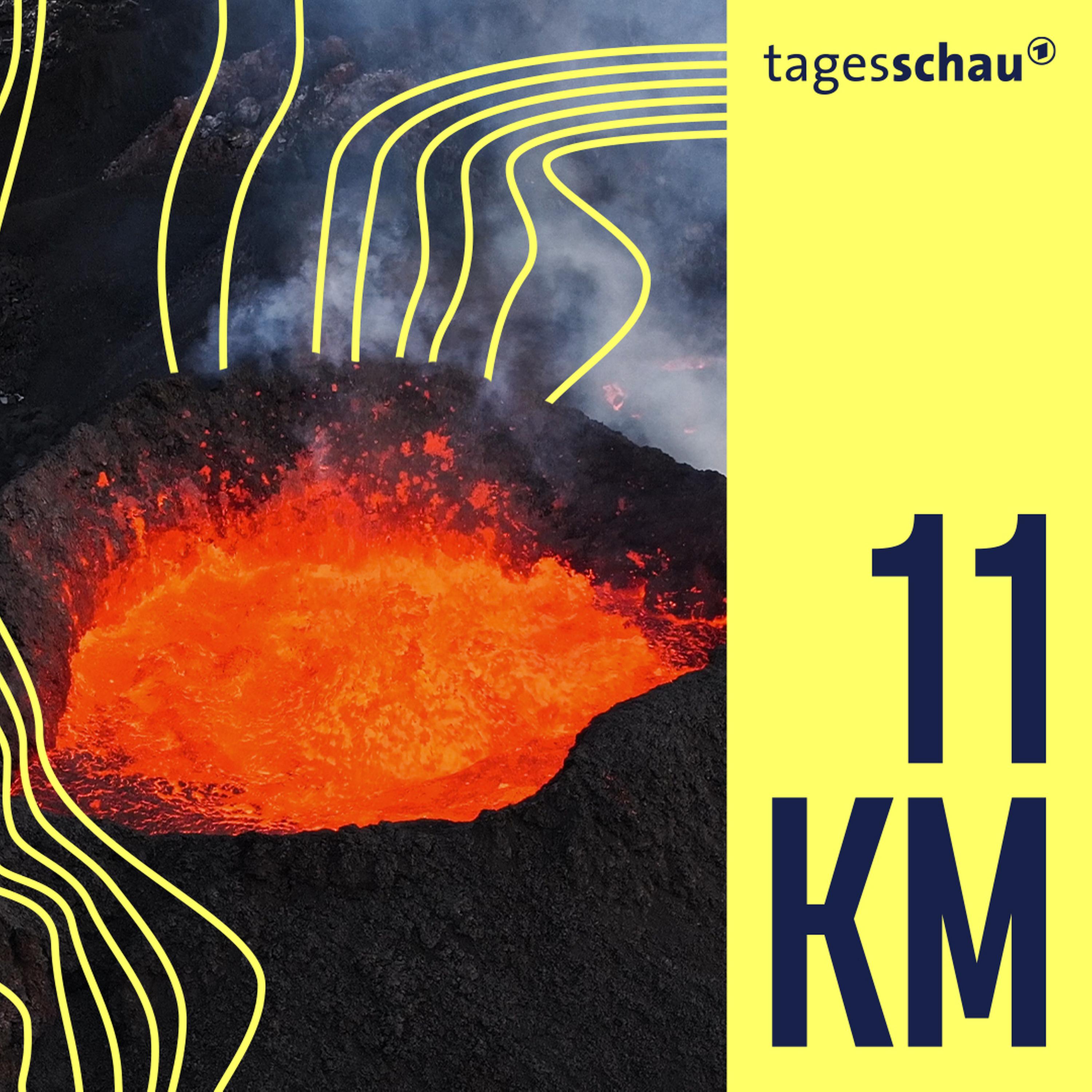 11KM: der tagesschau-Podcast
