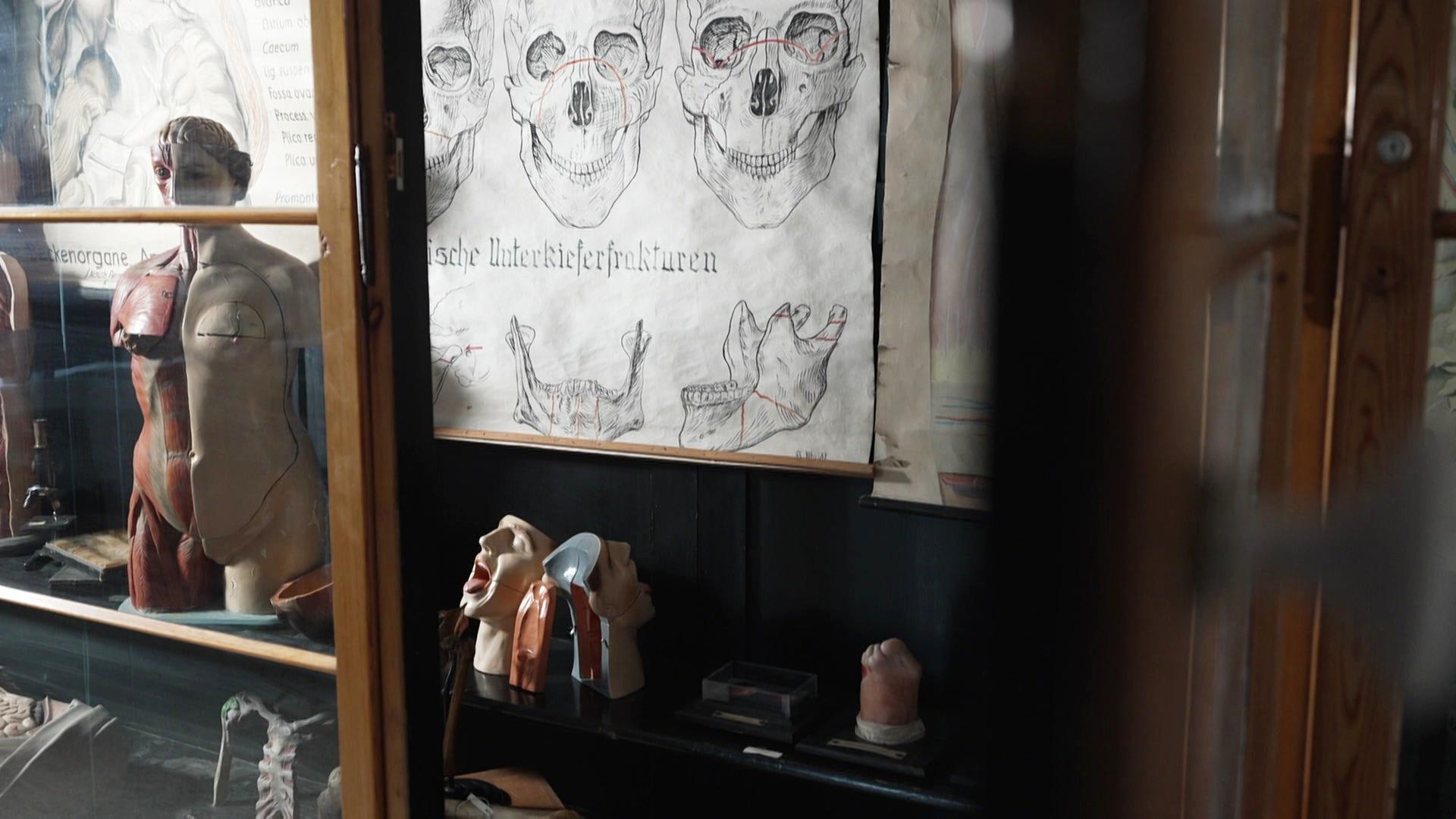 Schädel ohne Namen: Schwierige Rückgabe menschlicher Überreste