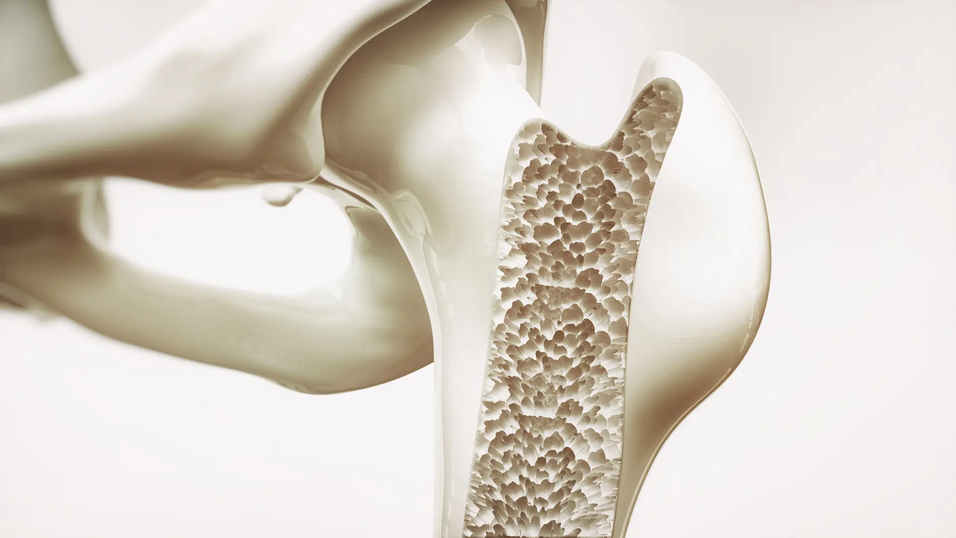 Osteoporosis: Recognize symptoms, initiate therapy early