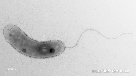 Mikroskop-Aufnahme des Vibrio Bakteriums.