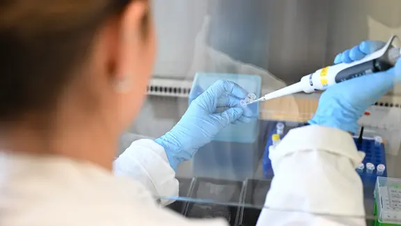 Ein Mitarbeiterin des Deutschen Krebsforschungszentrums arbeitet mit einer digitalen Pipette.