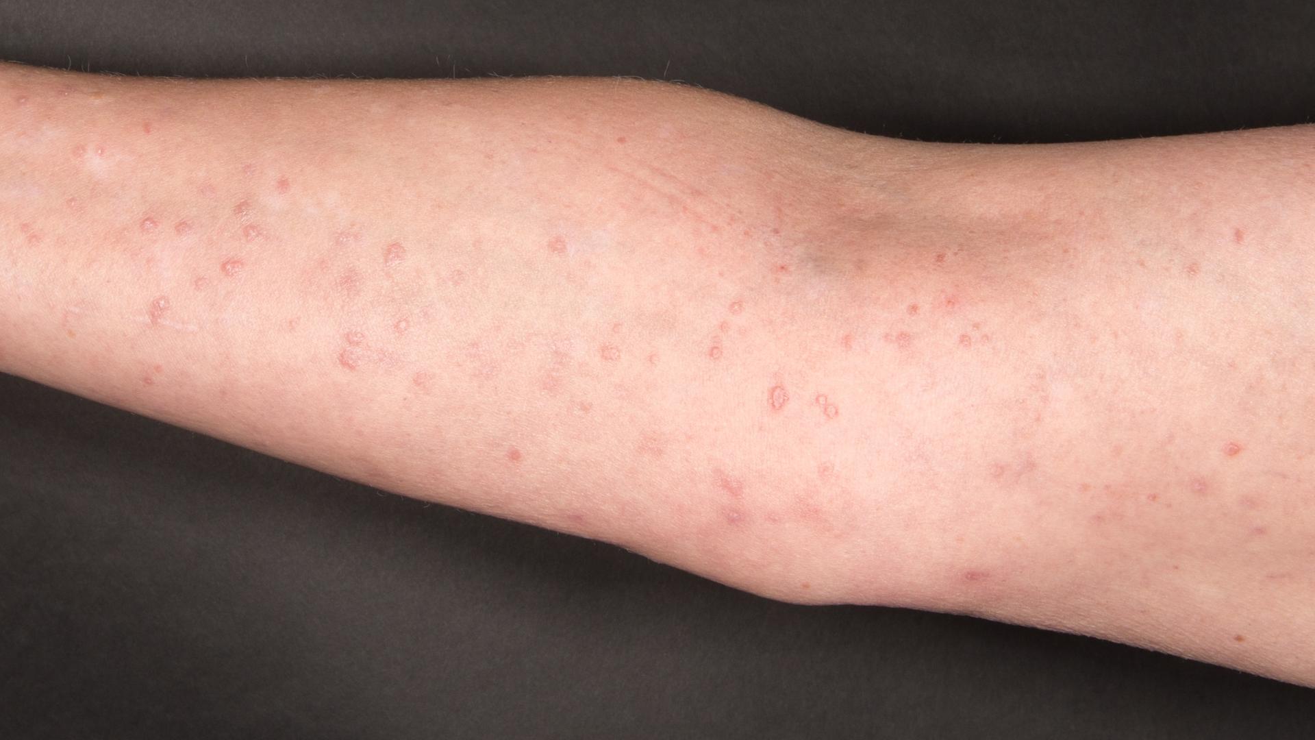 Mushuk ichiga sperma porno quyish