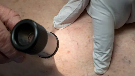 A doctor examines a patient's skin area in the practice. | picture alliance/dpa | Peter Kneffel A doctor examines a patient's skin area in the practice.