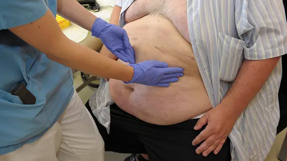 Eine Person in medizinischer Kleidung und Handschuhen tastet bei einem sehr übergewichtigem Mann den Bauch ab.