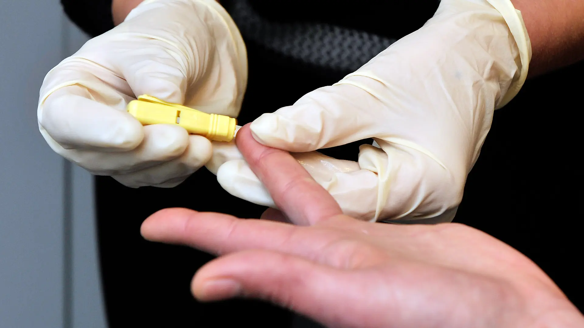 Gesundheitsamt St. Wendel bietet kostenlose Tests auf HIV, Syphilis und Hepatitis