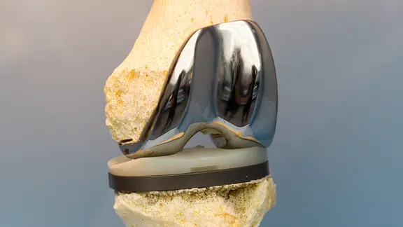 Detailaufnahme eines künstlichen Gelenkes. | Colourbox, - Detailaufnahme eines künstlichen Gelenkes.