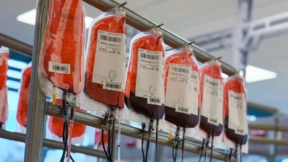 Blutspendebeutel hängen erhöht an einer Stange.