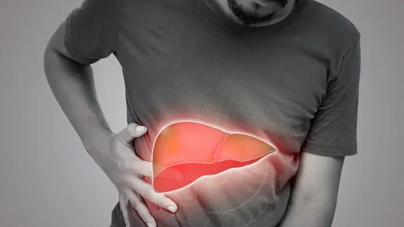 Leberzirrhose: Man hält sich seitlich Brustkorb, darauf ist die Grafik der Leber