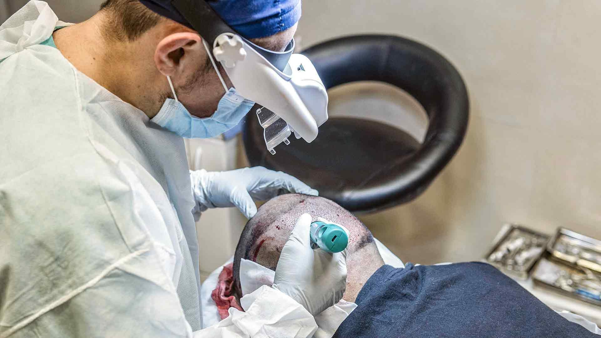Haartransplantation: Methoden, Kosten und Ergebnisse
