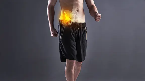 3D-Grafik eines Hüftgelenks auf Bild eines Mannes in Sportshorts (Bild: colourbox.de/Peopleimages.com)