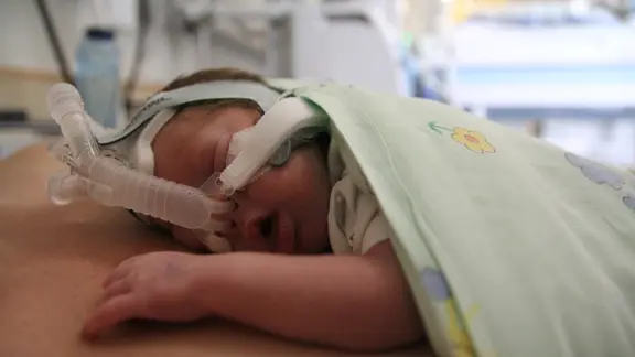 Ein Säugling welcher auf der Brust der Mutter liegt. 