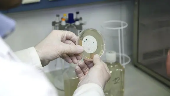 Jemand hält eine Platte mit Bakterien drauf.