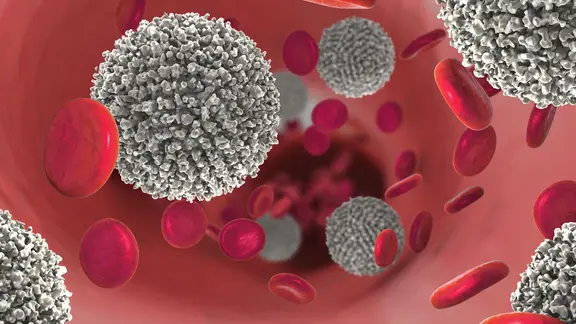 Computer-Illustration entarteter Leukozyten in der Blutbahn | picture alliance / Zoonar, Christoph Burgstedt Computer-Illustration entarteter Leukozyten in der Blutbahn