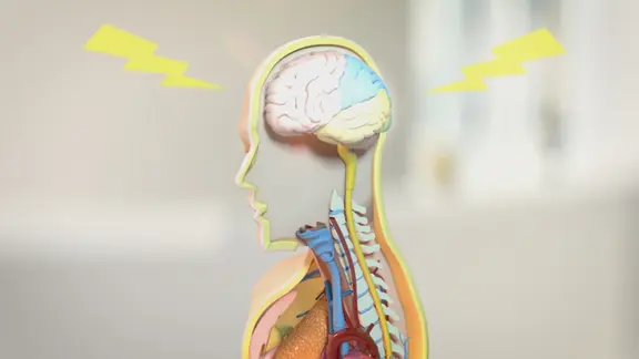 Schematische Darstellung: menschliches Gehirn, um das Blitze zucken. | NDR Schematische Darstellung: menschliches Gehirn, um das Blitze zucken.