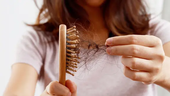Eine Frau hält eine Bürste voller Haare in den Händen.