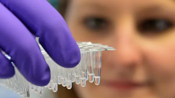 Biologielaborantin Miriam Hersina entnimmt Proben mit einer Pipette im Landesamt für Verbraucherschutz und Lebensmittelsicherheit (Laves) in Oldenburg. | dpa-Bildfunk, Carmen Jaspersen Biologielaborantin Miriam Hersina entnimmt Proben mit einer Pipette im Landesamt für Verbraucherschutz und Lebensmittelsicherheit (Laves) in Oldenburg.