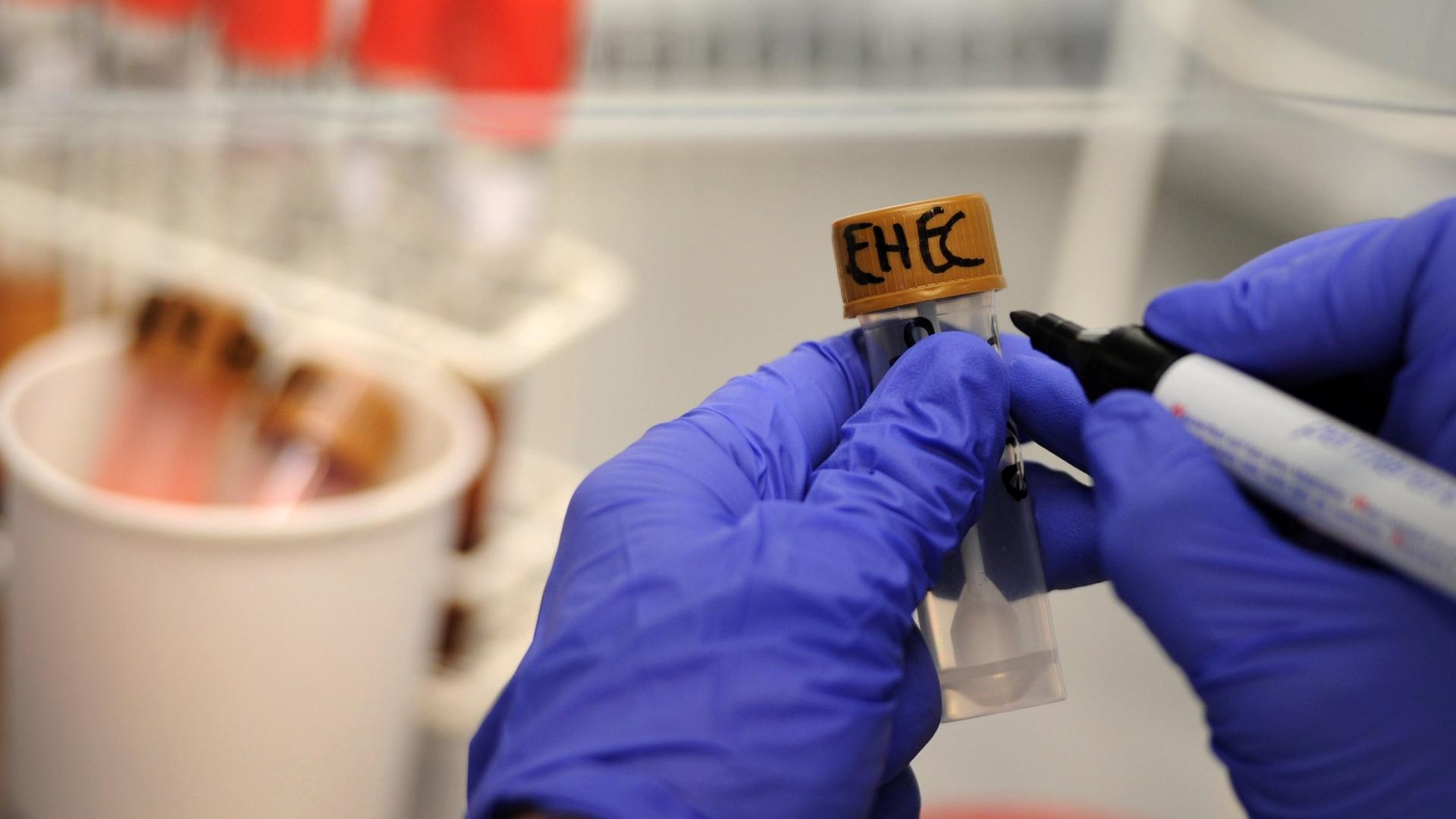 EHEC-Infektionen in Hamburg: Mehr Fälle, aber kein Ausbruch