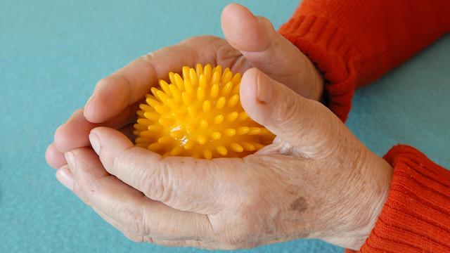 weißfingerkrankheit vibration Weißfingerkrankheit Silberhandschuhe helfen