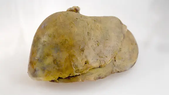 So sieht eine Fettleber aus: überdimensioniert, hart, gelblich. | NDR Eine Fettleber liegt auf dem Tisch.